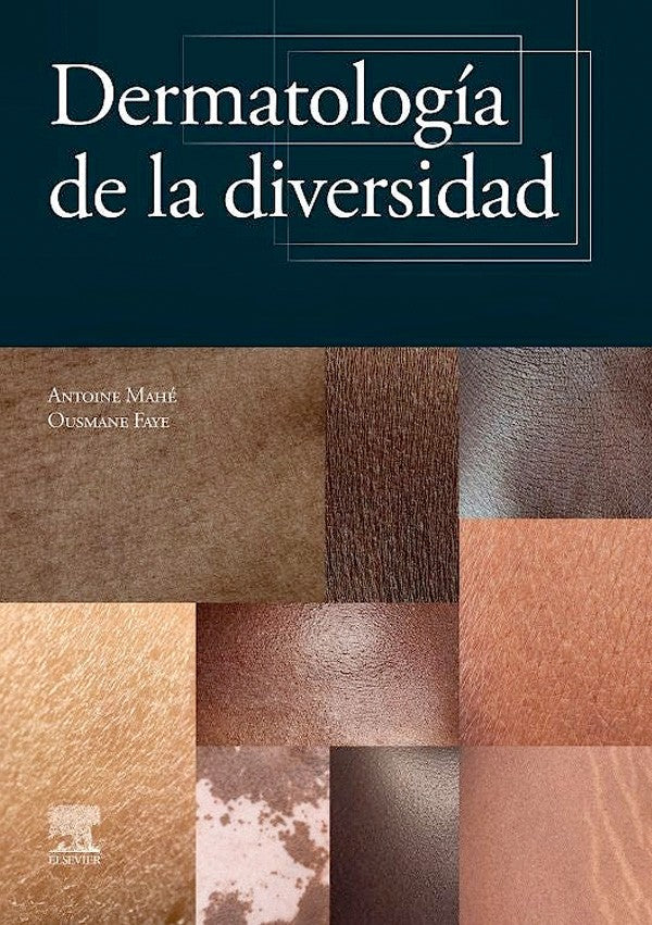 Dermatología de la diversidad