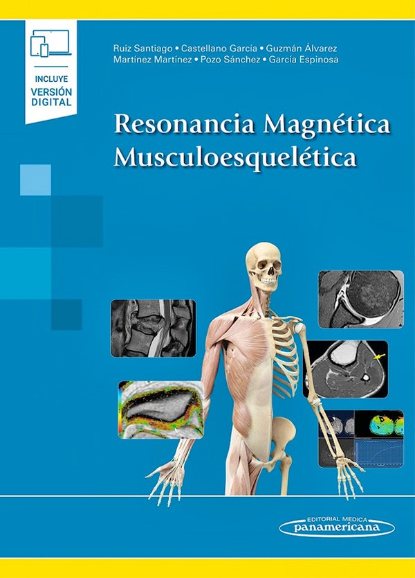 Resonancia magnética musculoesquelética