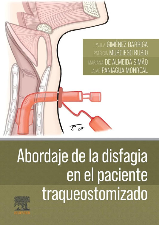 Abordaje de la disfagia en el paciente traqueostomizado