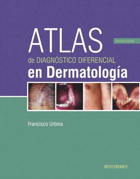 Atlas de diagnóstico diferencial en dermatología 2ª Ed.