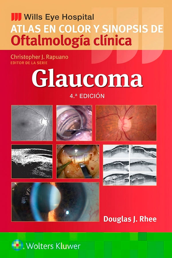 Atlas en color y sinopis de Oftalmología clínica. Glaucoma. Wills Eye Hospital