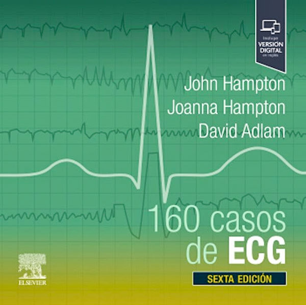 160 casos de ECG