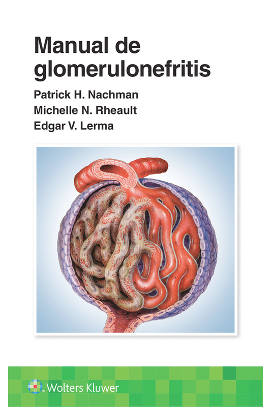 Manual de glomerulonefritis