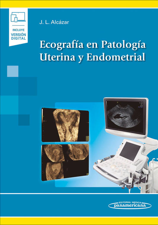 Ecografía en patología uterina y endometrial