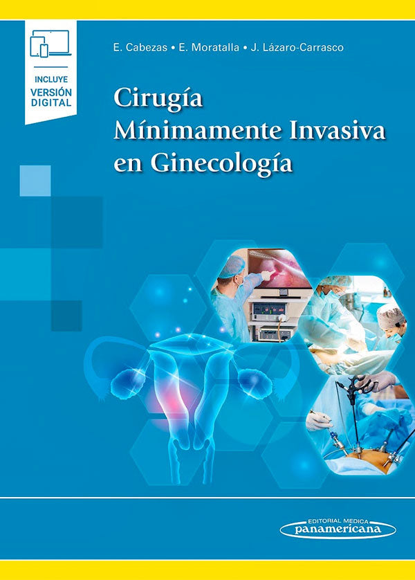 Cirugía minimamente invasiva en ginecología