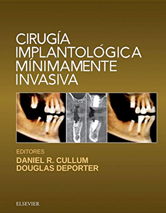 Cirugía implantológica mínimamente invasiva