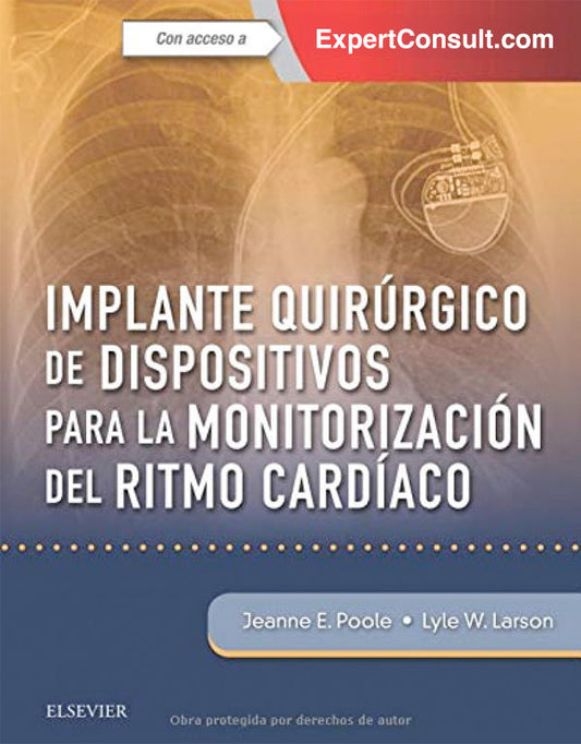 Implantes quirúrgicos de dispositivos para la monitorización del ritmo cardíaco