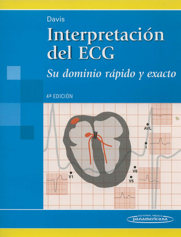 Interpretación del ECG 4ª Ed.